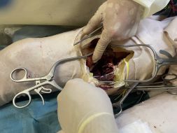 Anatomical Right Lower Limb